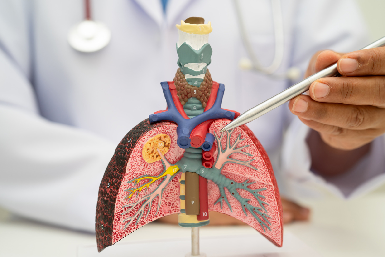 4 types of lung surgery