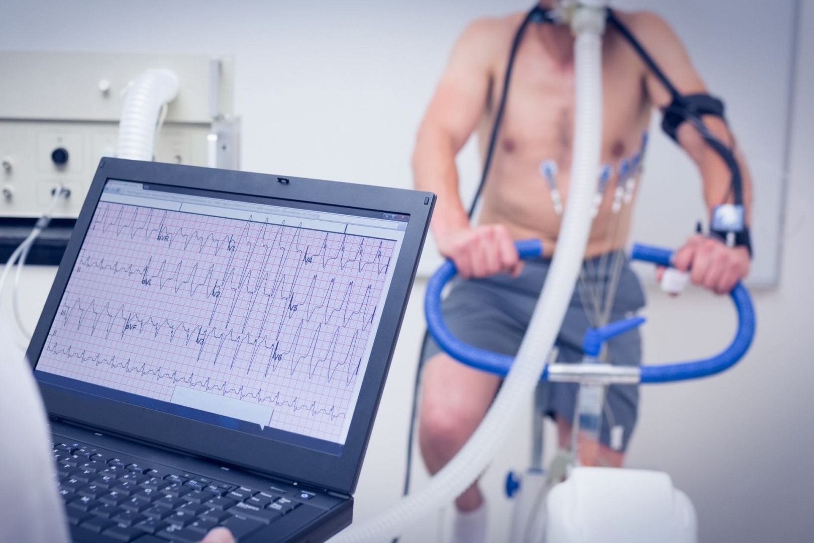 Cardiopulmonary Exercise Testing to detect lung cancer