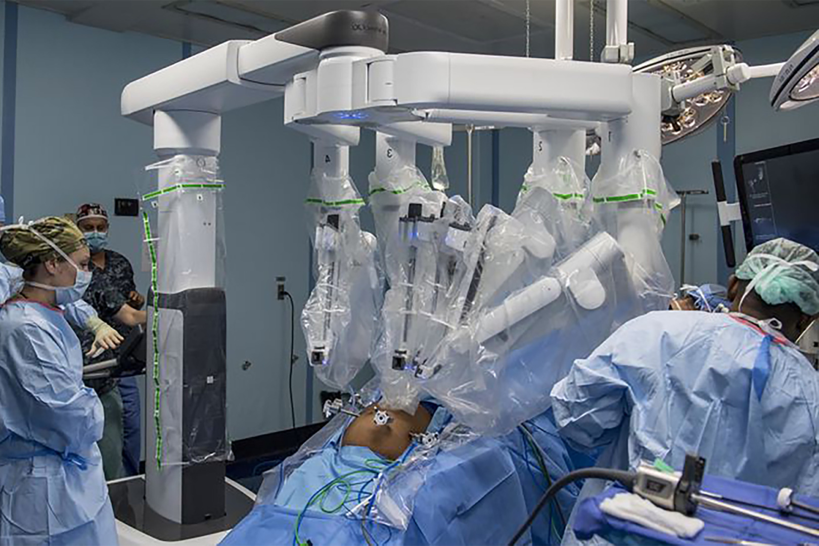 RATS for meditastinal masses surgery