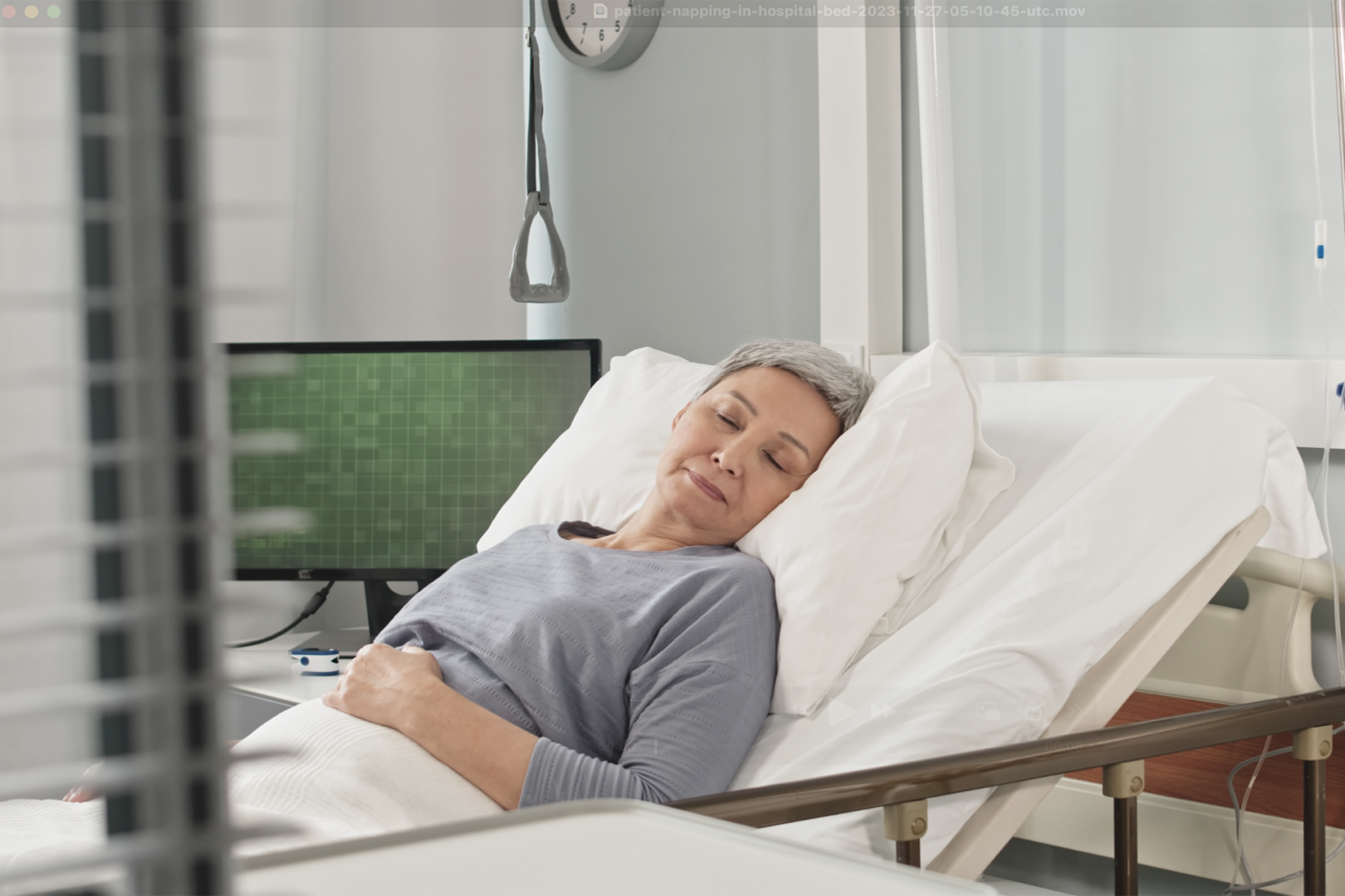 VATS mediastinal tumour outcomes