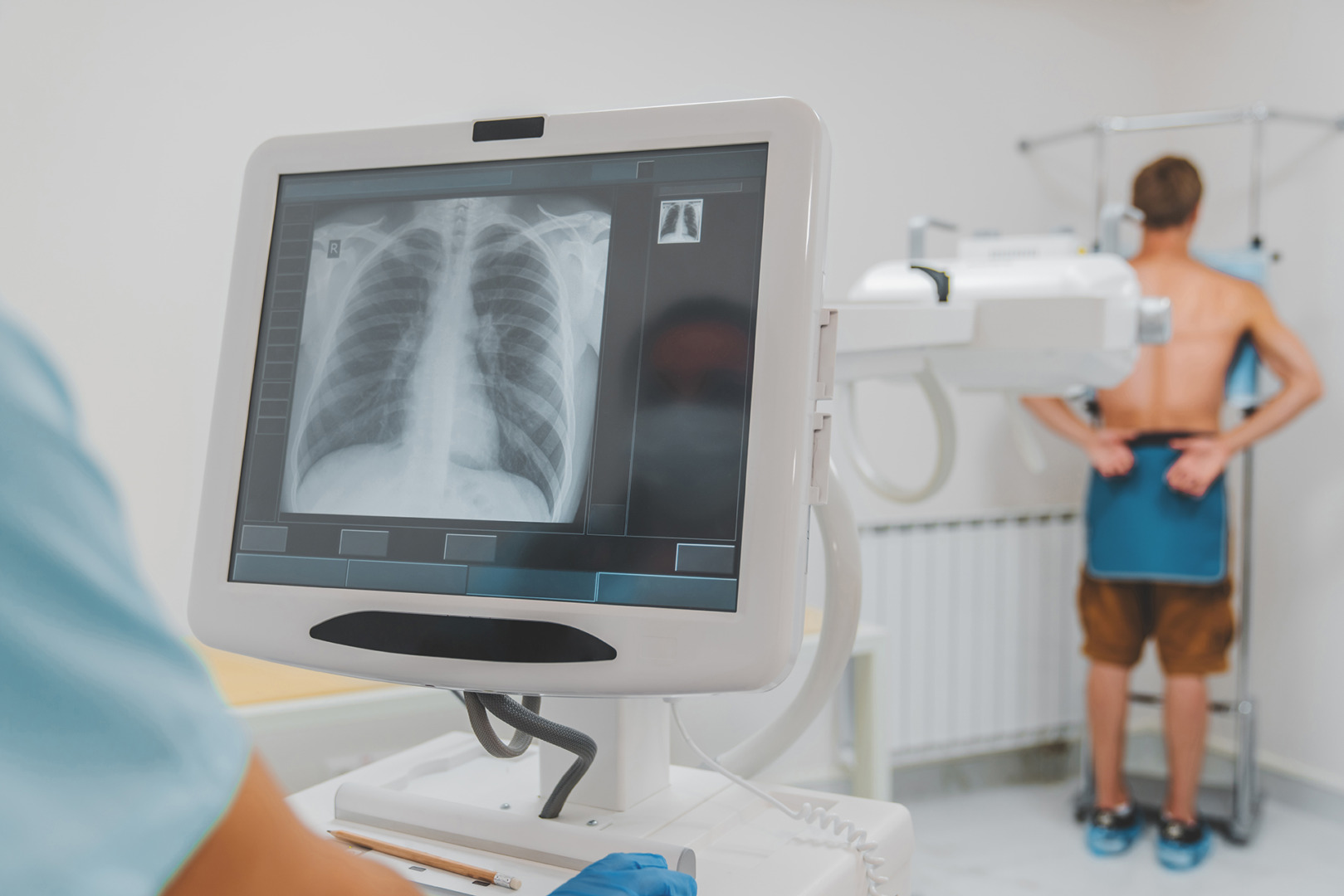 Chest xray to diagnose small pneumothorax