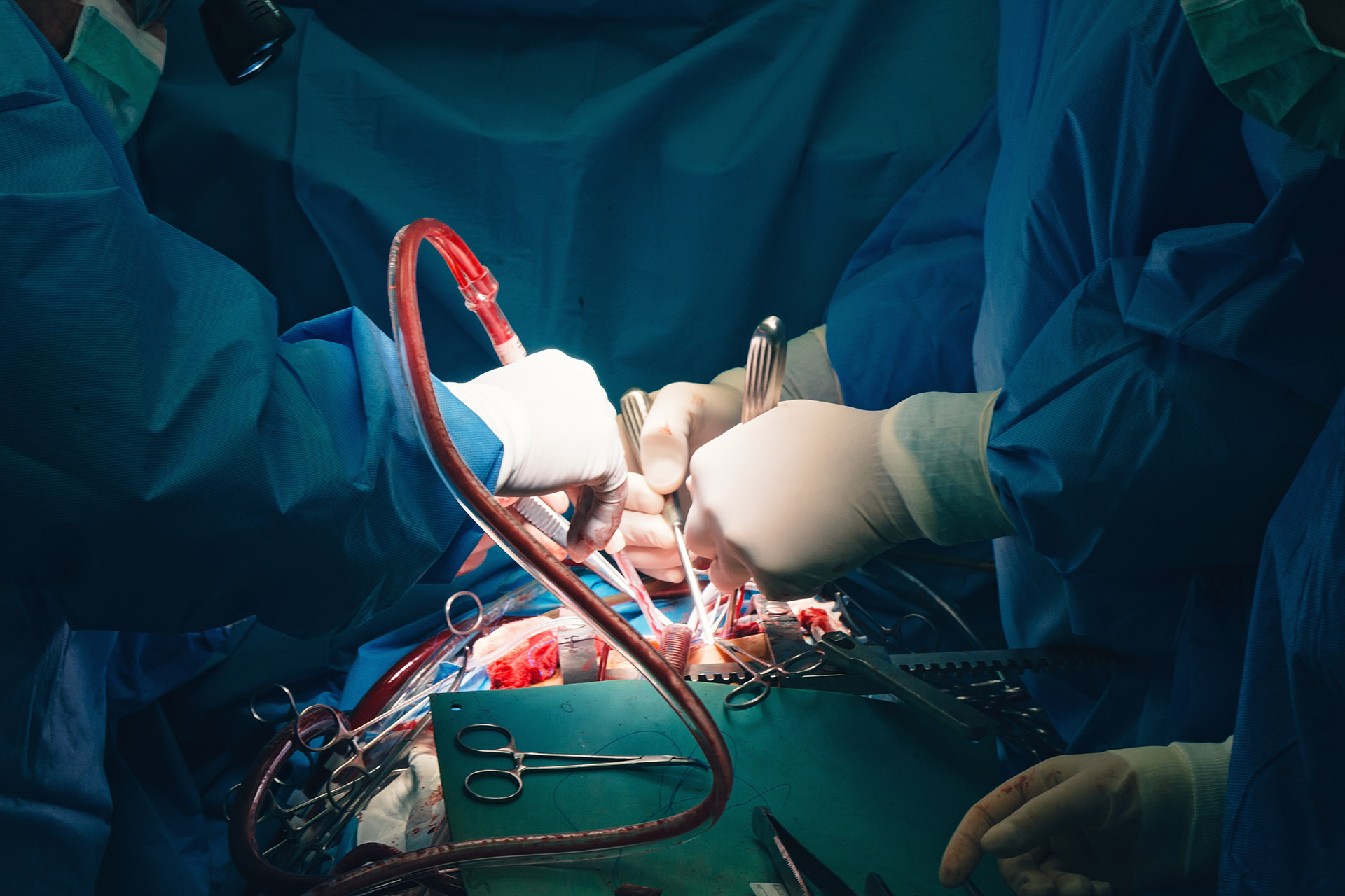 collapsed lung treatment surgery