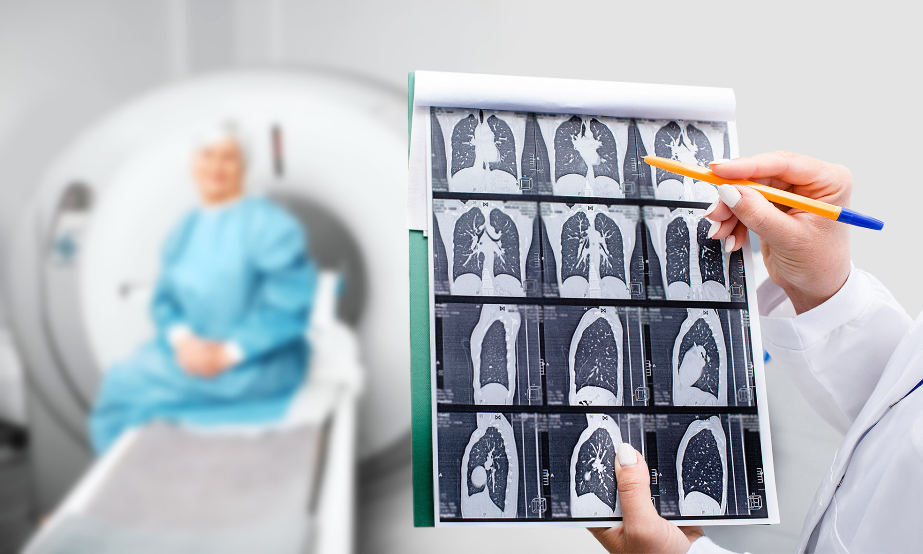how to detect stage 1 lung cancer