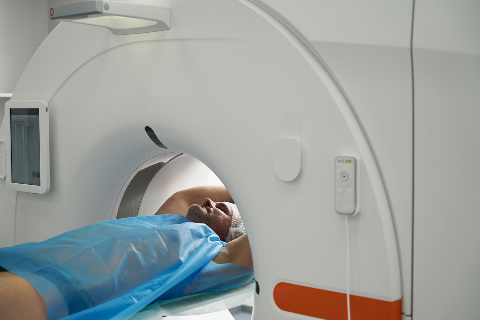 Low-Dose CT Scan for Lung Cancer Screening