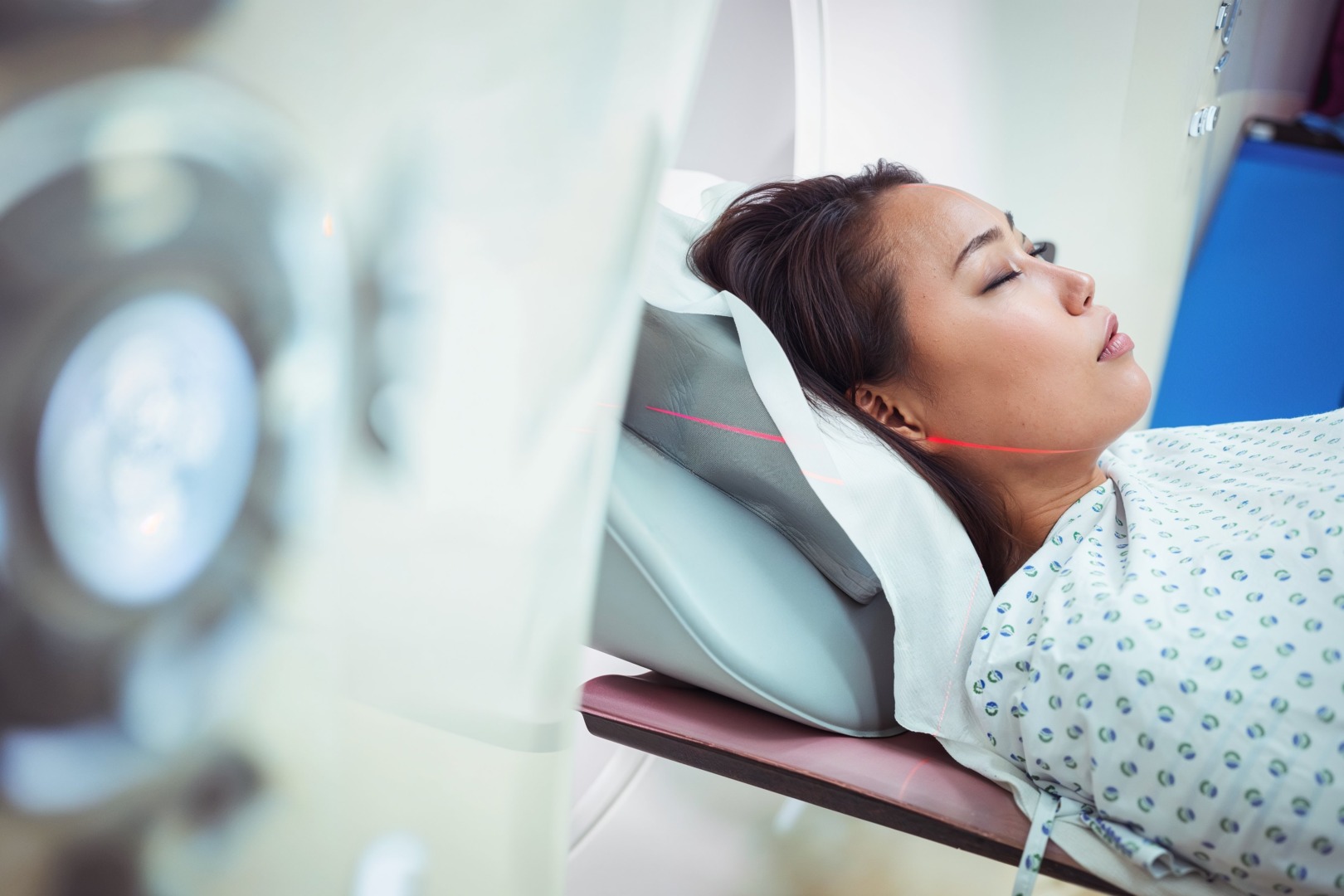 lung nodule detection
