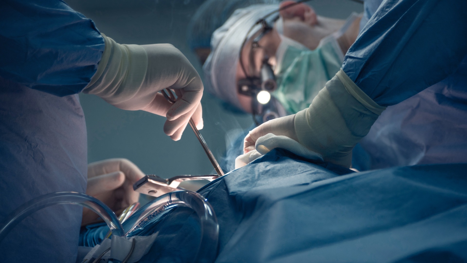 lung nodule removal surgery