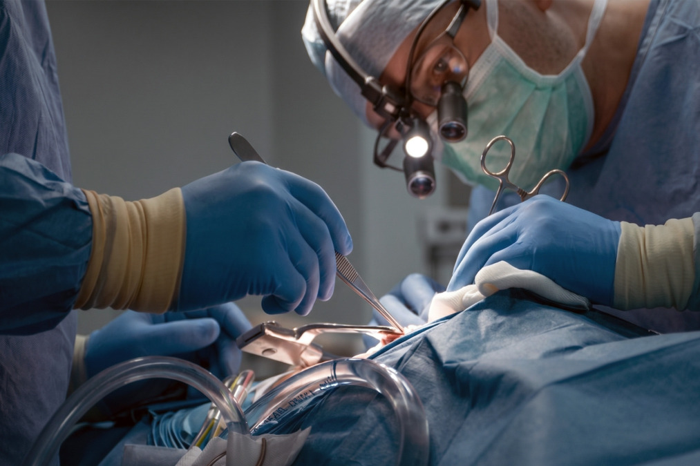 malignant mesothelioma surgery