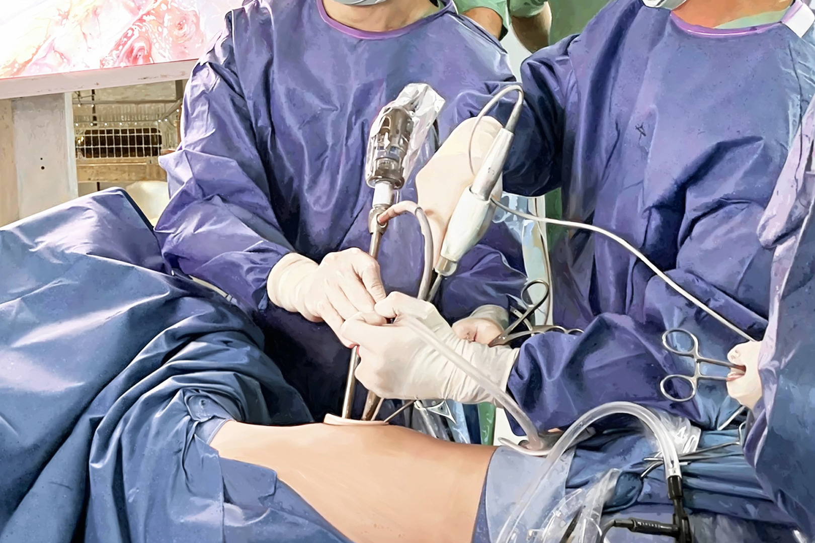 mediastinal mass treatment VATS