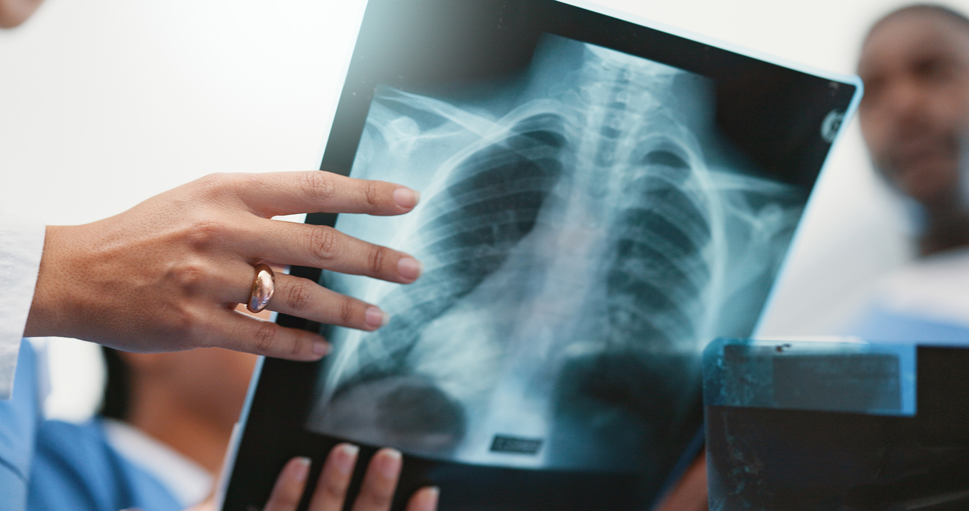 nodule on lung