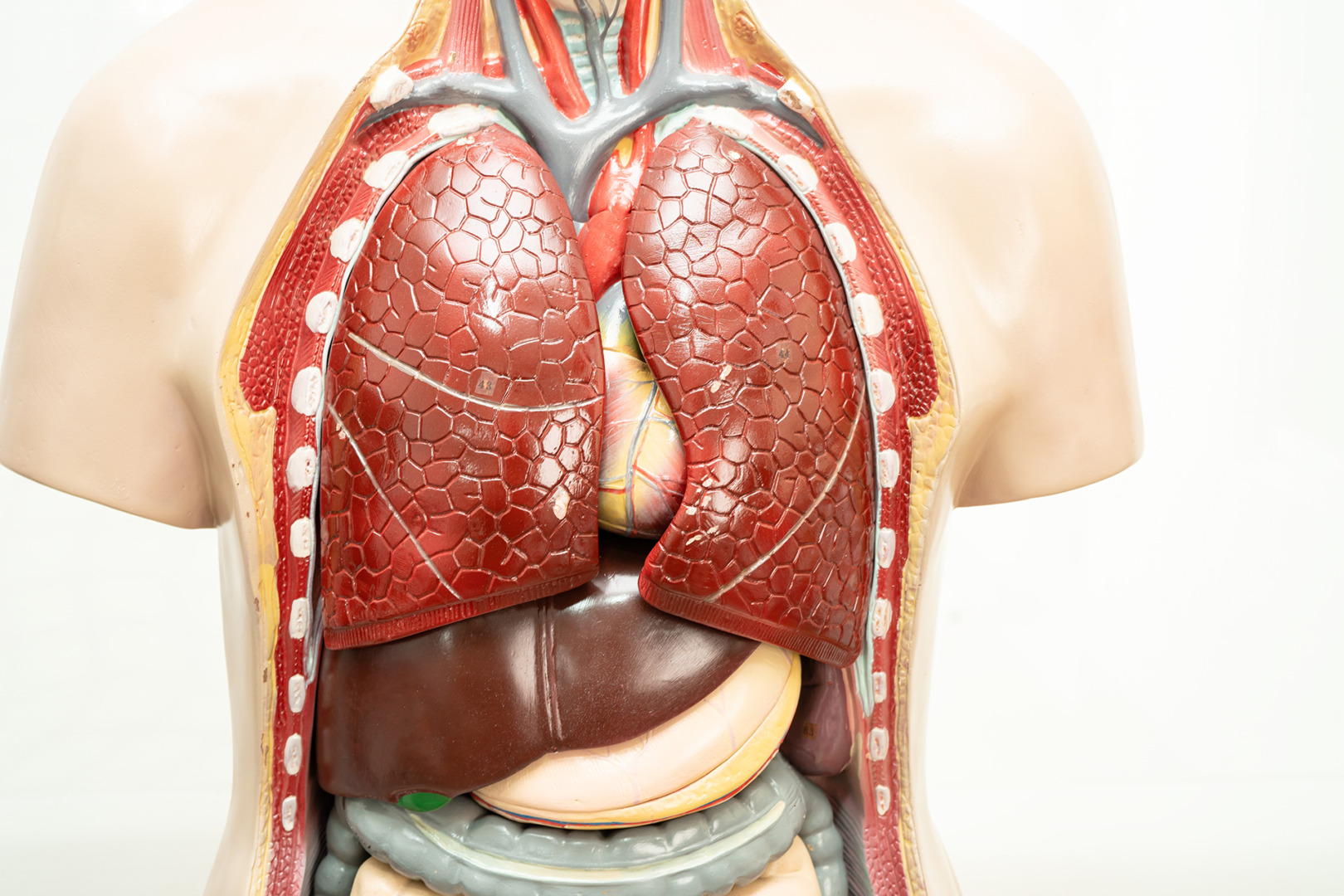open pneumothorax Singapore