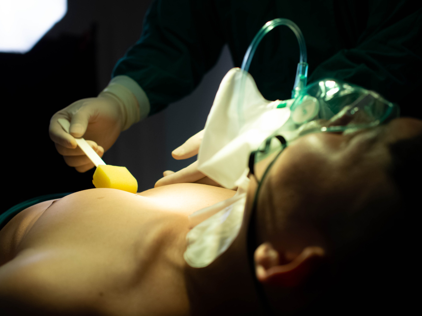 pectus excavatum surgery in adults Singapore recovery