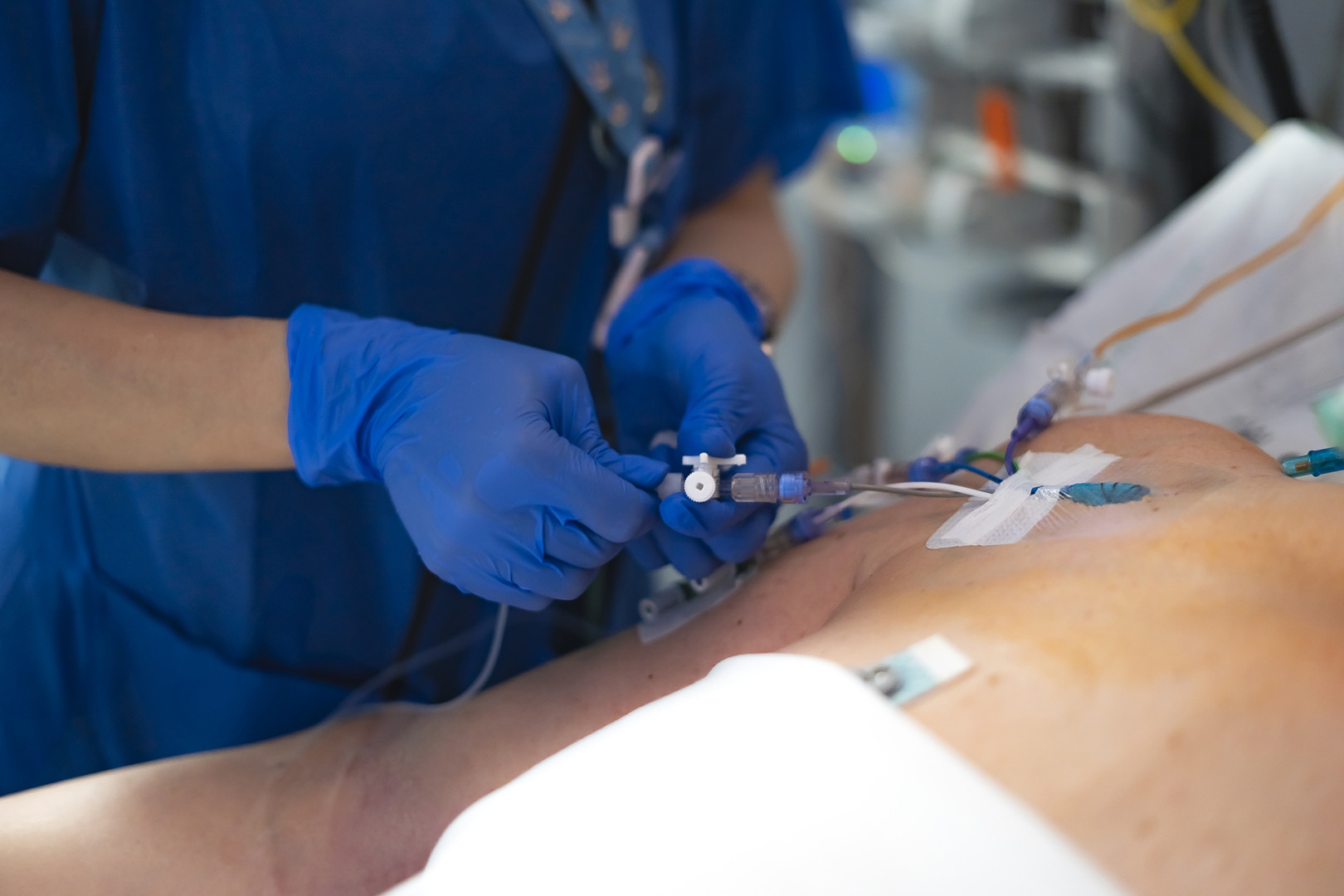 pleural effusion thoracotomy