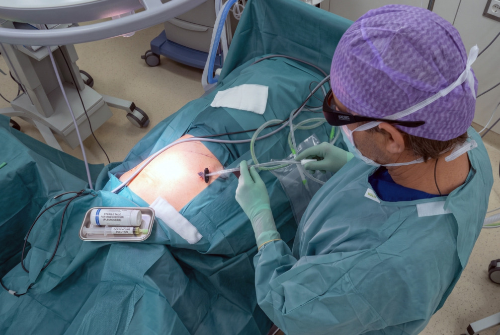 pleurodesis procedure