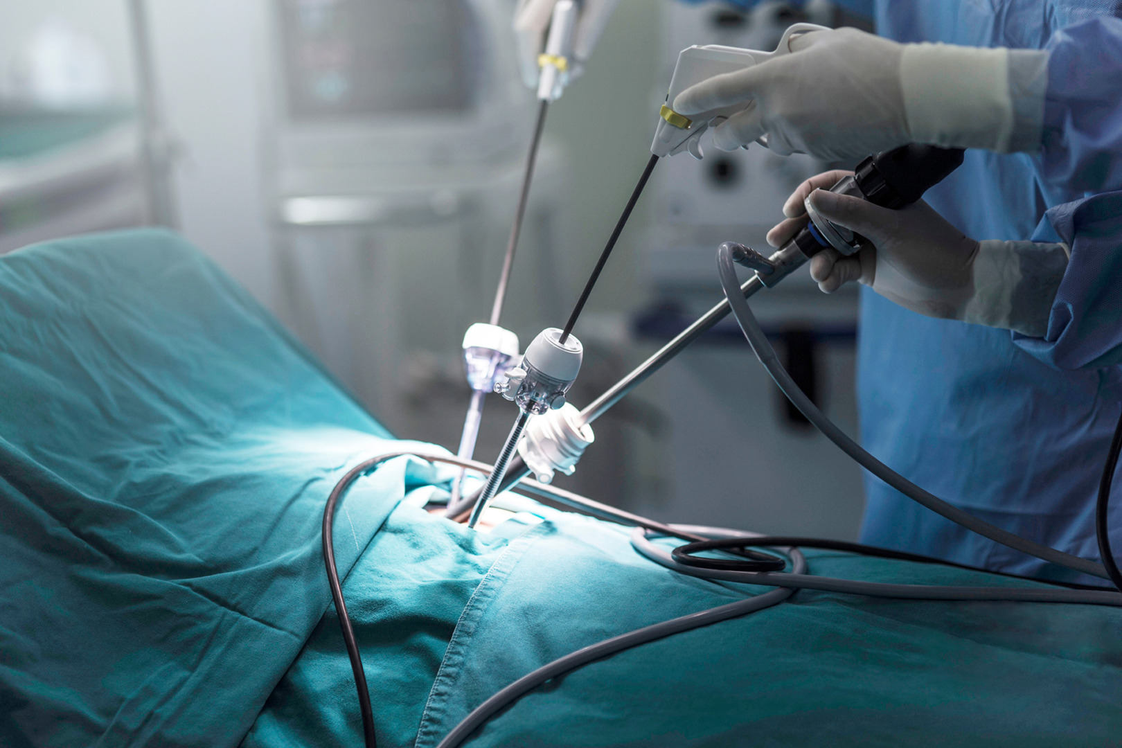 pneumothorax surgery