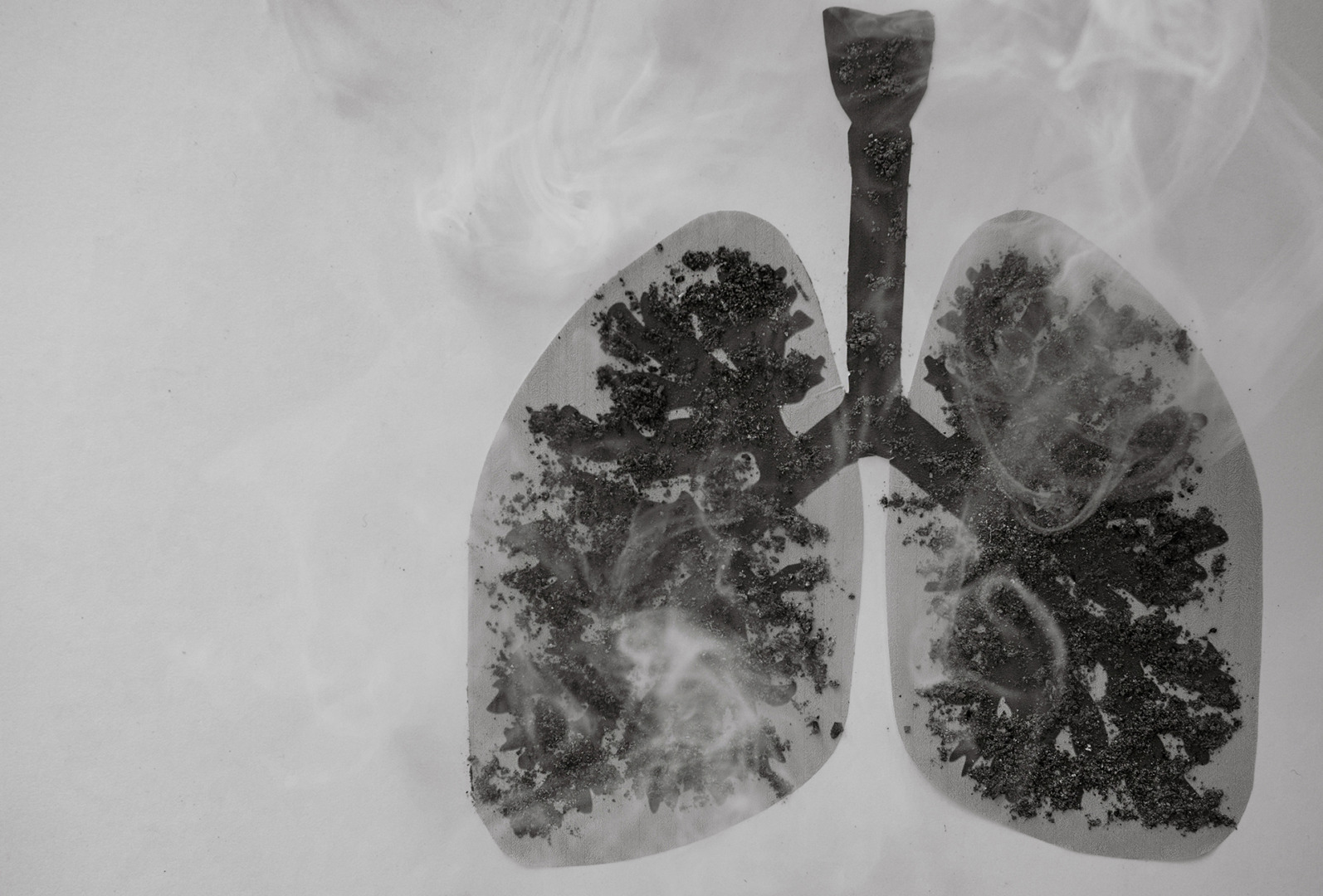 pulmonary nodule