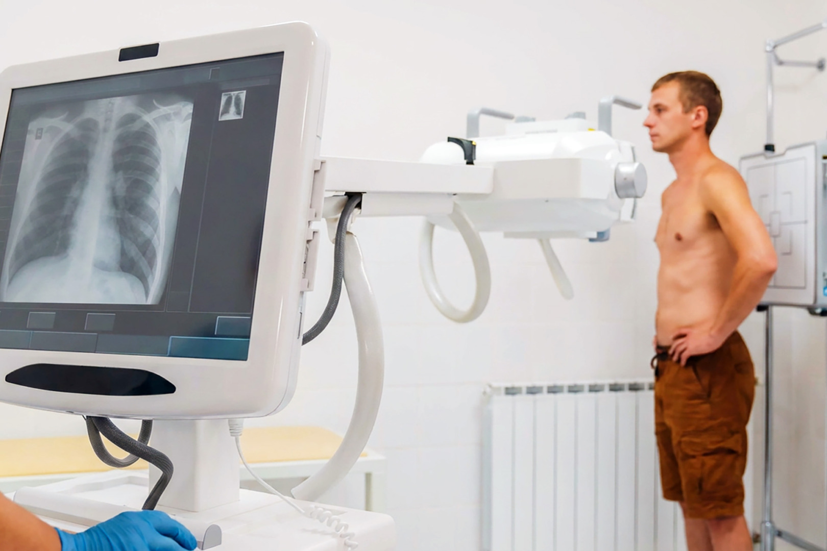 pulmonary oedema vs pleural effusion test