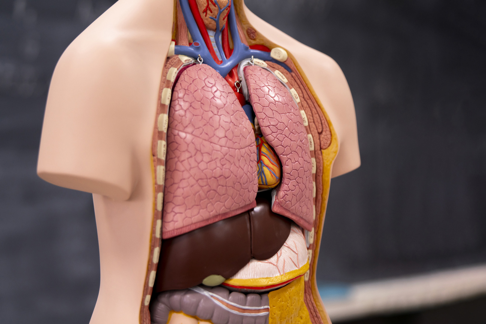 superior mediastinal mass chest
