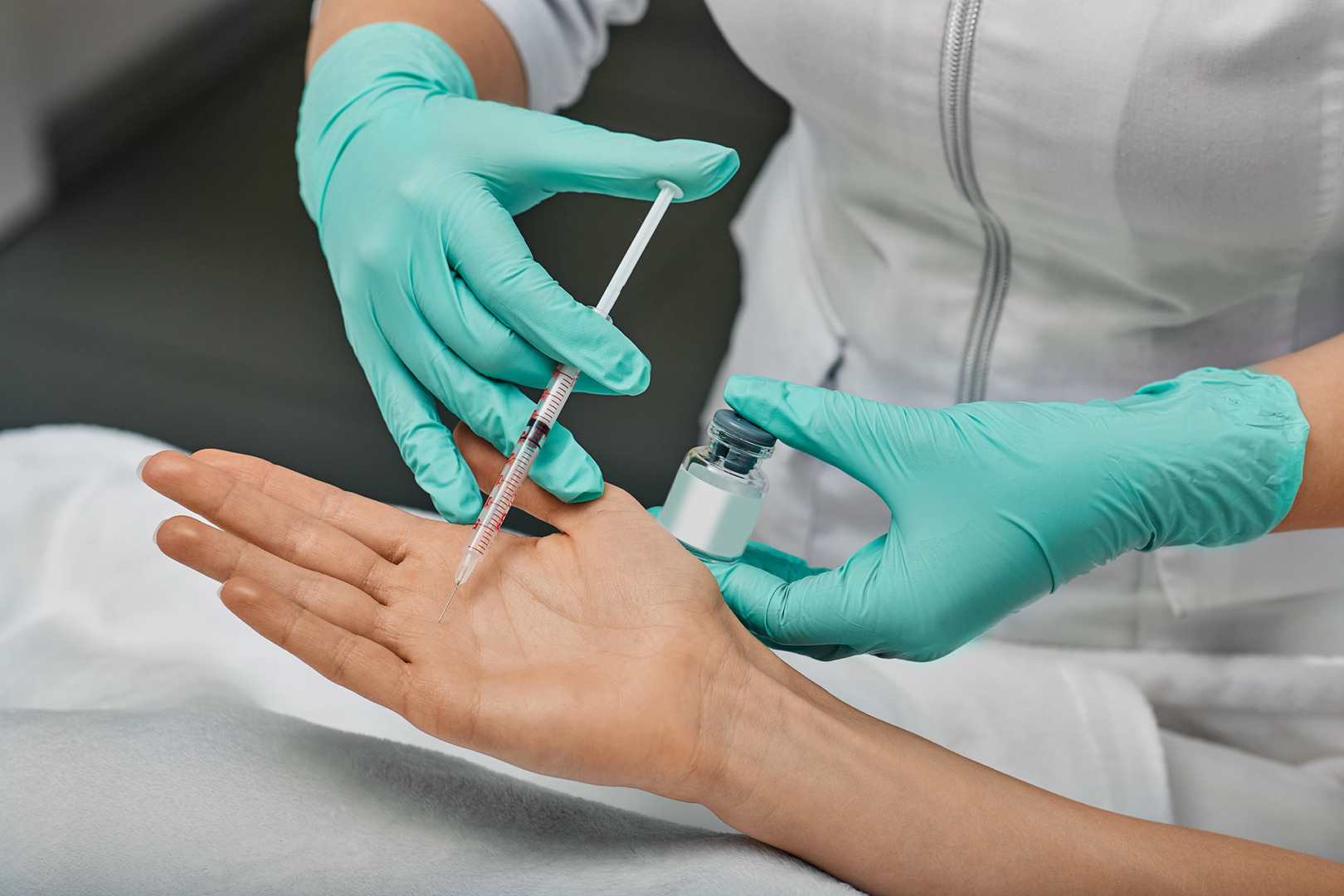 sweaty hands cure