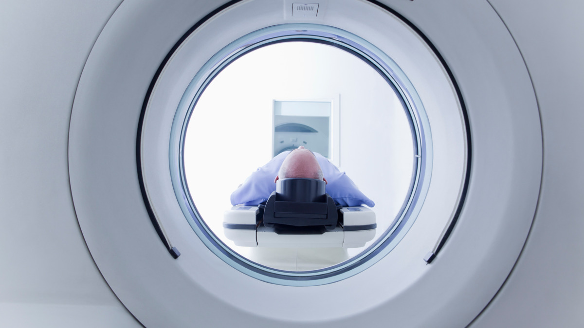 Endoscopic Thoracic Sympathectomy for Hyperhidrosis Neumark