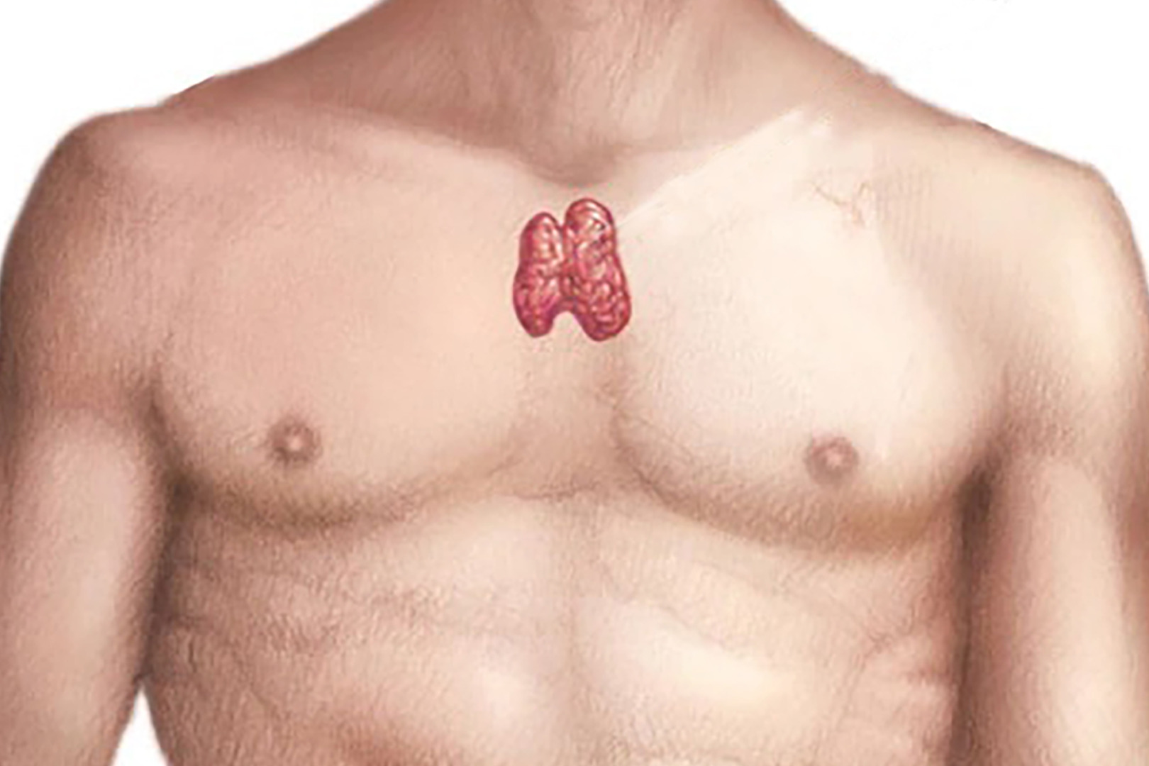 thymus cancer causes