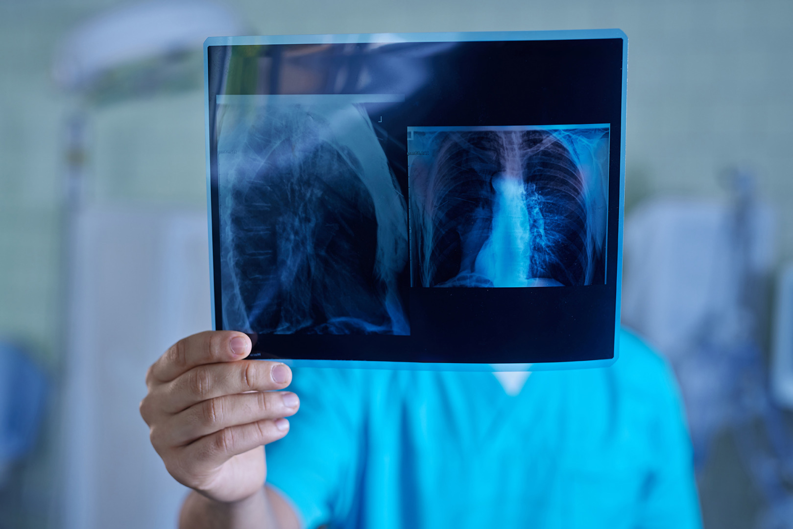types of lung cancer