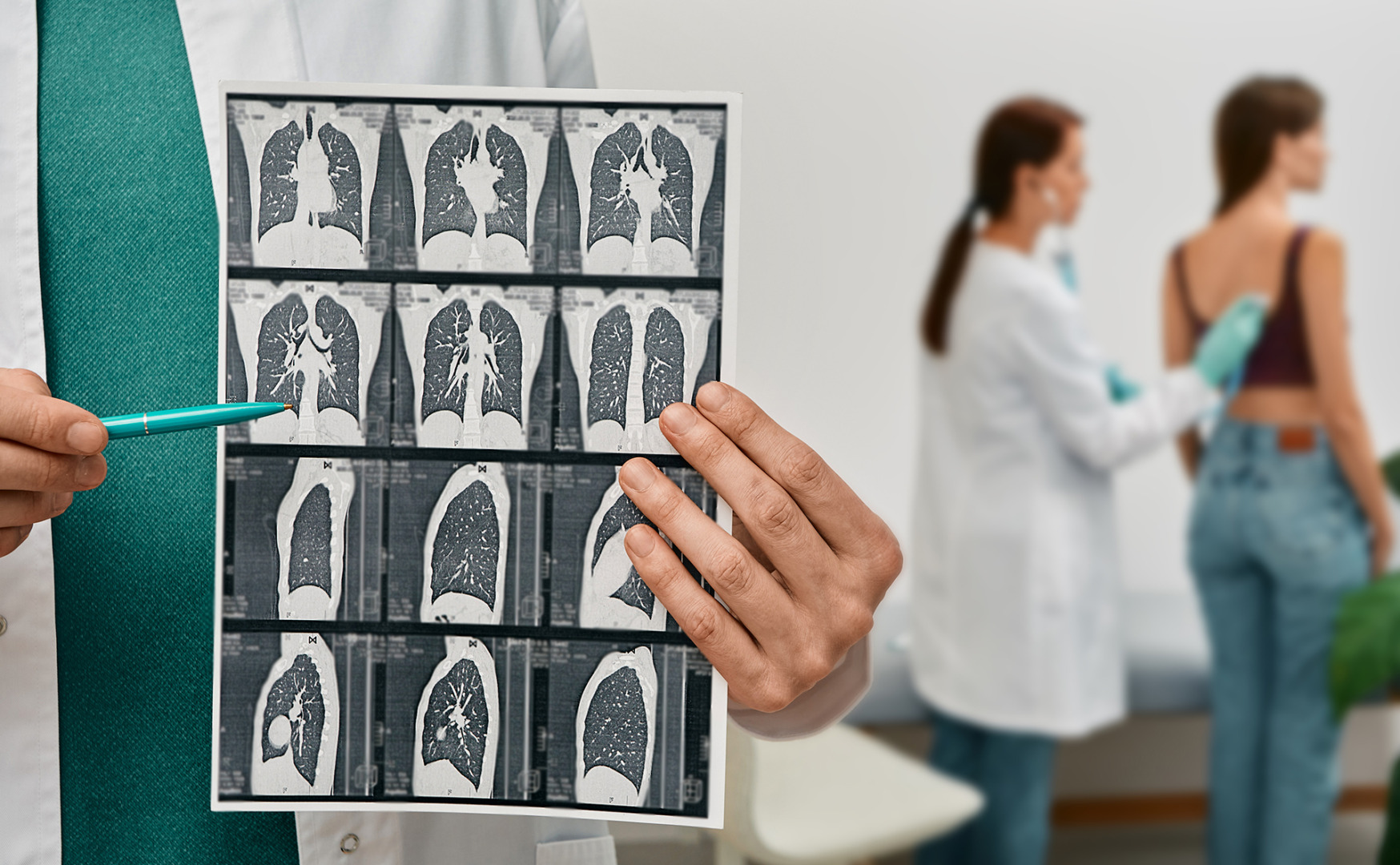 what is a subpleural nodule