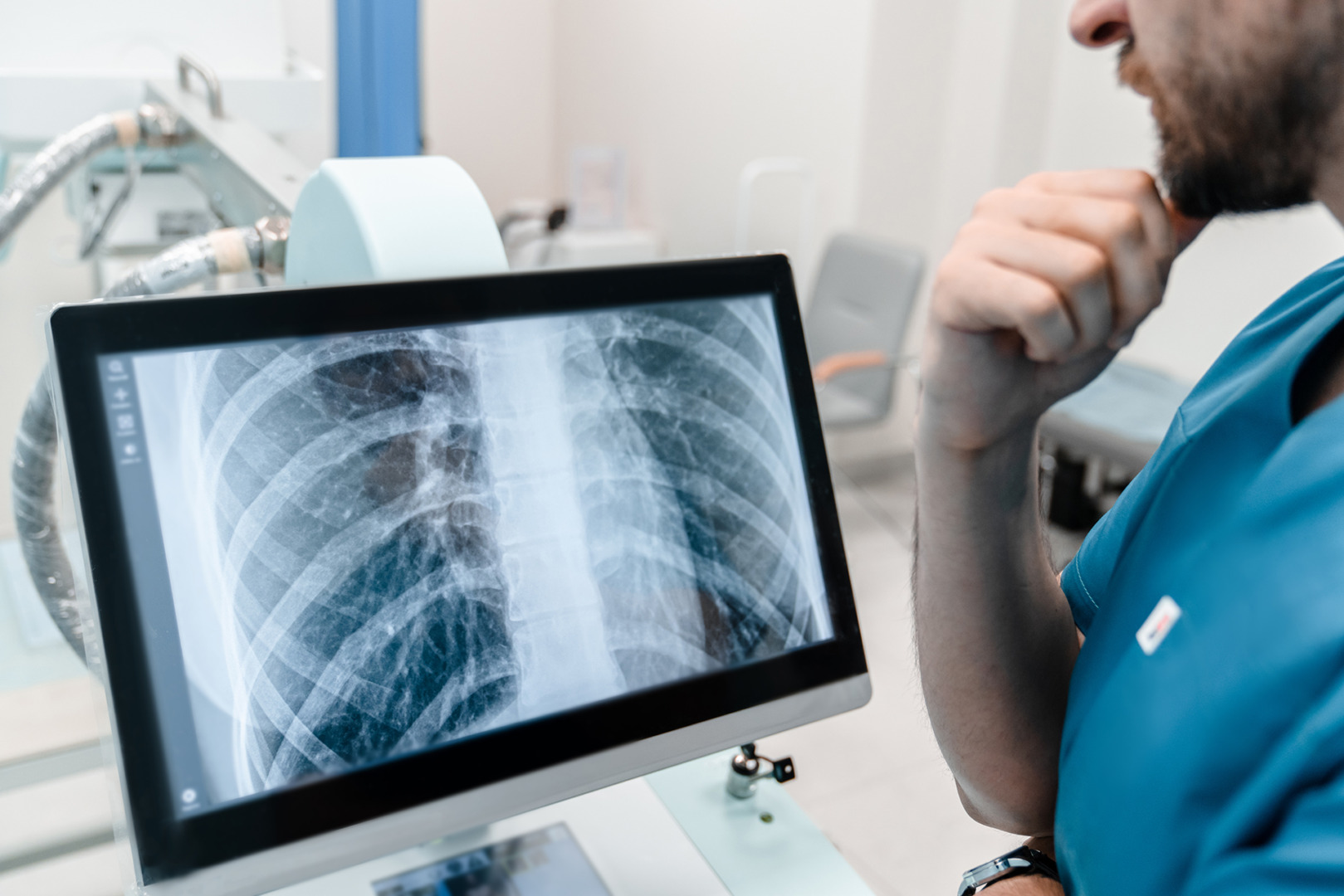 white spot on lungs diagnosis