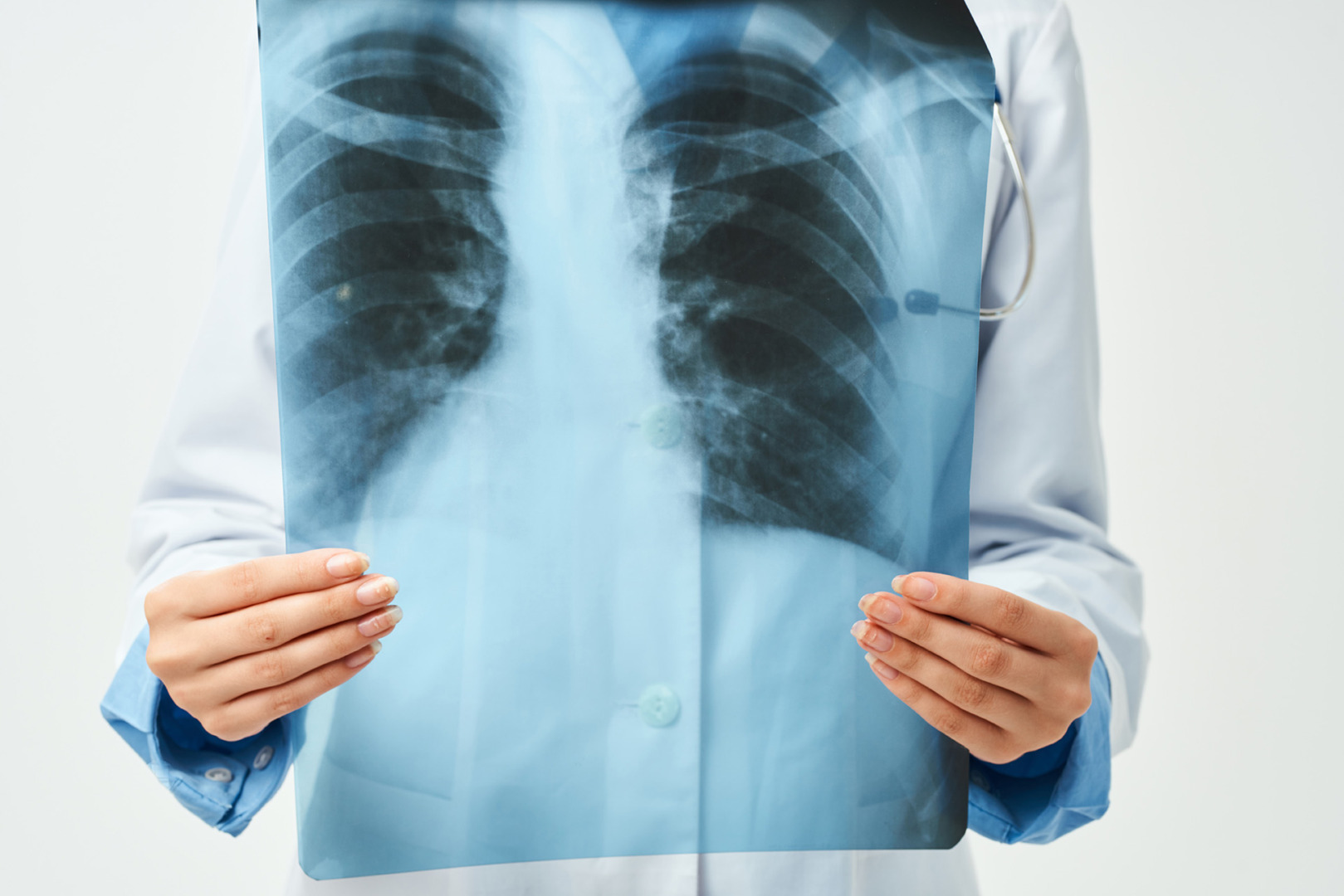 white spot on lungs